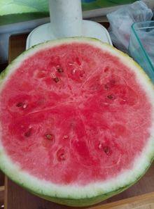 医院吃瓜,揭秘医疗现场的温馨瞬间